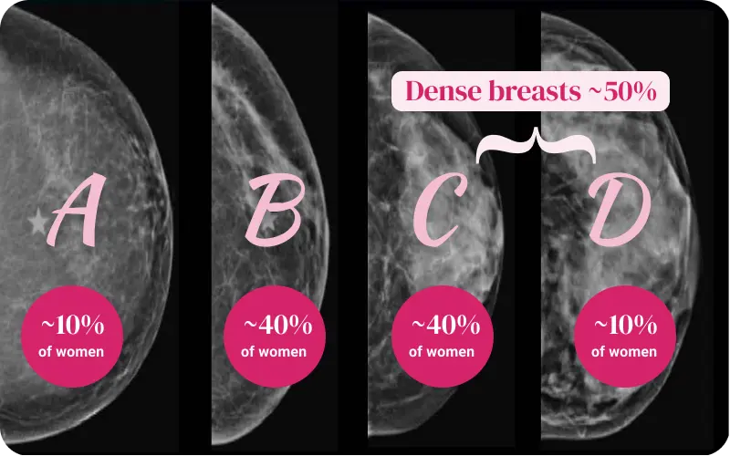 Breast density categories